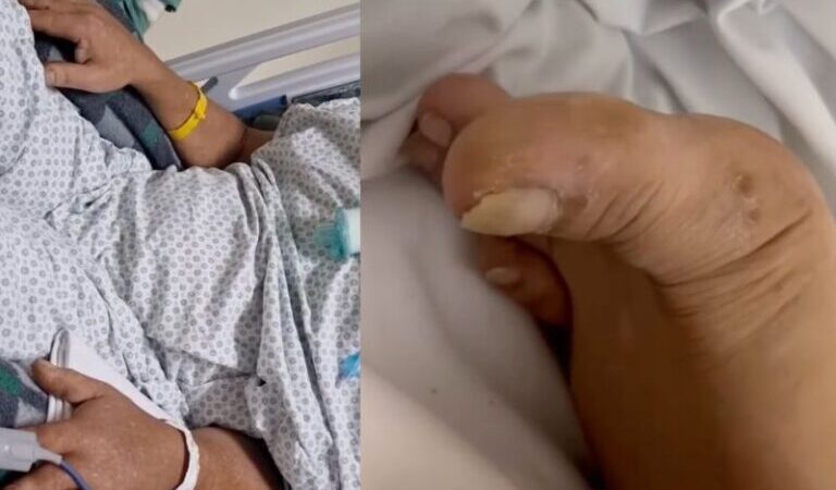 Mais um paciente tetraplégico mexe os braços e dedo do pé, após receber a polilaminina; vídeo